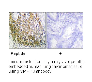 MMP-10 Antibody - image 2