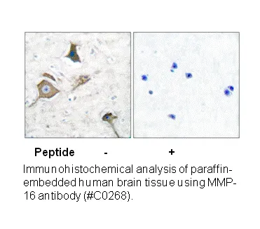 MMP-16 Antibody - image 1