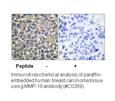 MMP-19 Antibody - image 2
