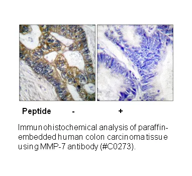 MMP-7 Antibody - image 1