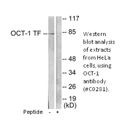 OCT1 Antibody - image 2