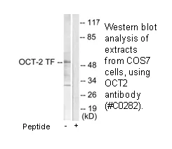OCT2 Antibody - image 2