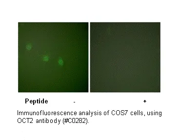 OCT2 Antibody - image 1