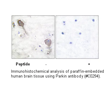 Parkin Antibody - image 1
