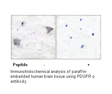 PDGFR α Antibody - image 2