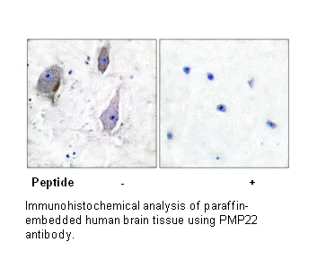 PMP22 Antibody - image 2