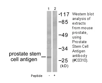 Prostate Stem Cell Antigen Antibody - image 1