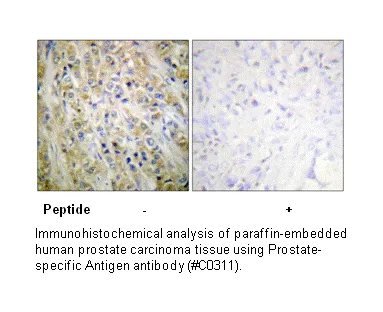 Prostate-specific Antigen Antibody - image 1