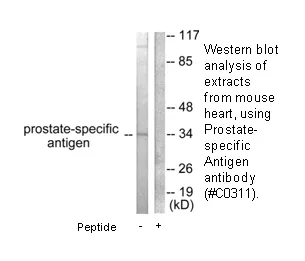 Prostate-specific Antigen Antibody - image 2