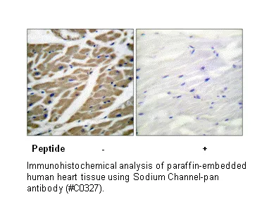 Sodium Channel-pan Antibody - image 1
