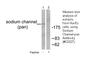Sodium Channel-pan Antibody - image 2