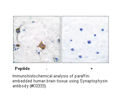 Synaptophysin Antibody - image 1