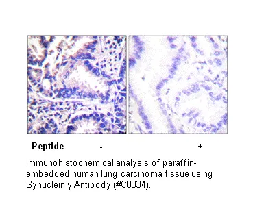 Synuclein γ Antibody - image 1