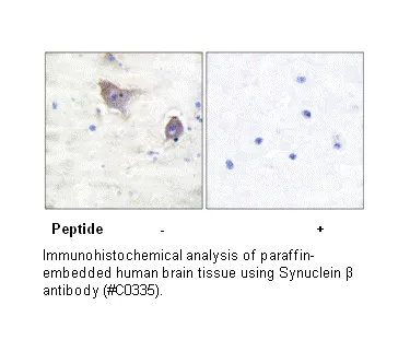 Synuclein β Antibody - image 2