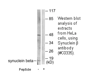 Synuclein β Antibody - image 3