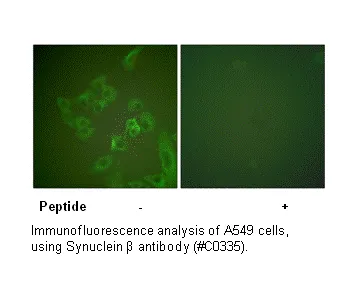 Synuclein β Antibody - image 1