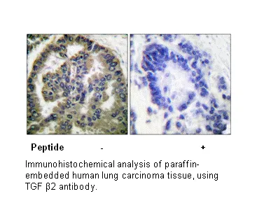 TGF β2 Antibody - image 1
