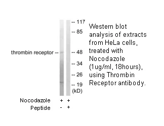 Thrombin Receptor Antibody - image 1