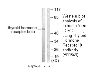 Thyroid Hormone Receptor β Antibody - image 1