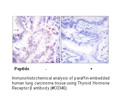 Thyroid Hormone Receptor β Antibody - image 2