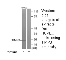 TIMP3 Antibody - image 1