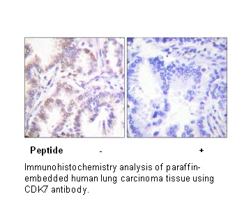 CDK7 Antibody - image 1