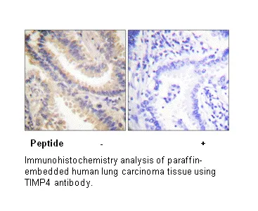TIMP4 Antibody - image 2