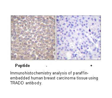 TRADD Antibody - image 1