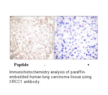 XRCC1 Antibody - image 1