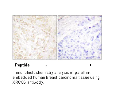 XRCC6 Antibody - image 1