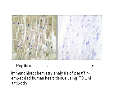 PDLIM1 Antibody - image 3