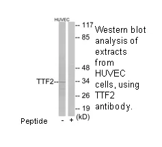 TTF2 Antibody - image 2