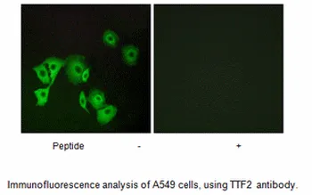 TTF2 Antibody - image 1