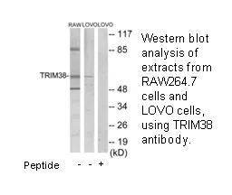 TRIM38 Antibody - image 1