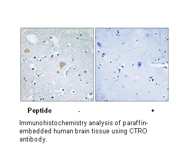 CTRO Antibody - image 1