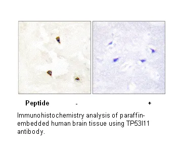 TP53I11 Antibody - image 1