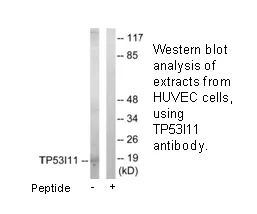 TP53I11 Antibody - image 2