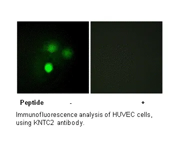 KNTC2 Antibody - image 2