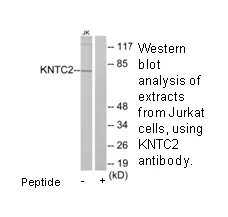 KNTC2 Antibody - image 1