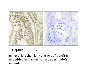 MAST4 Antibody - image 2