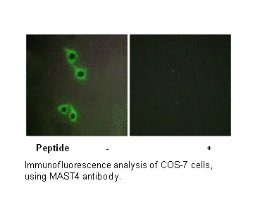 MAST4 Antibody - image 1