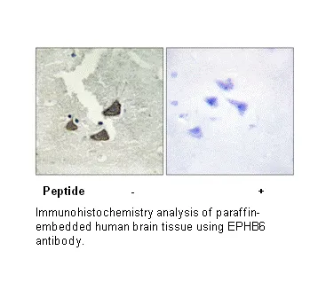 EPHB6 Antibody - image 2