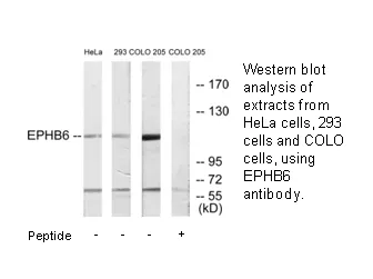 EPHB6 Antibody - image 3