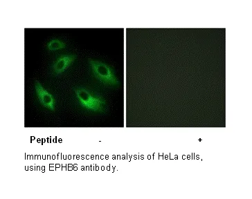 EPHB6 Antibody - image 1