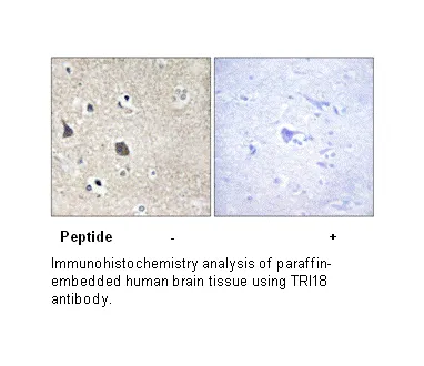 TRI18 Antibody - image 2