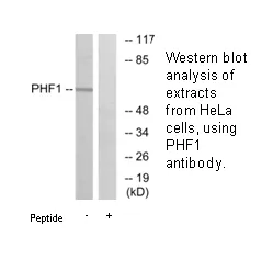 PHF1 Antibody - image 1
