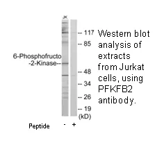 6-Phosphofructo-2-Kinase Antibody - image 1