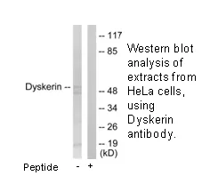 Dyskerin Antibody - image 2
