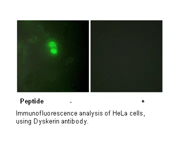 Dyskerin Antibody - image 1