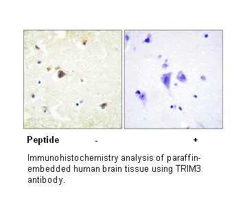 TRIM3 Antibody - image 3